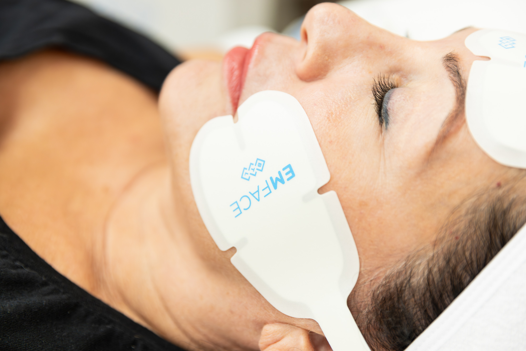 Emface Skin Tightening & Lifting